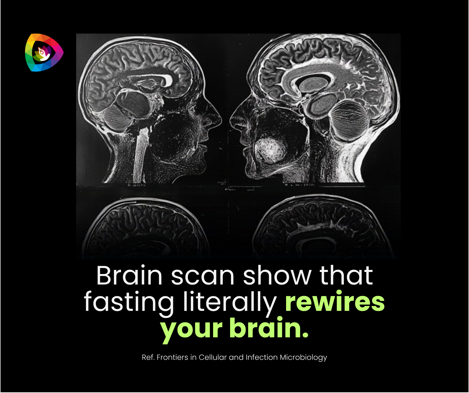 fasting-rewires-brain